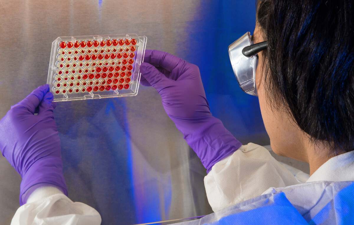 CDC scientist examines the results of a hemagglutinin inhibition (HI) test.